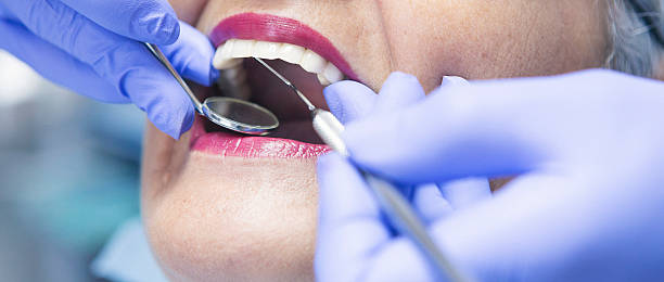 Best Emergency Treatment for Dental Infections or Abscesses in Flossmoor, IL